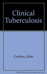 Clinical Tuberculosis