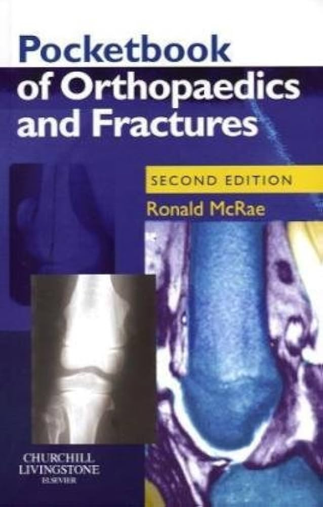 Pocketbook Of Orthopaedics And Fractures (Mcrae)